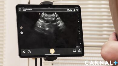 Anal Ultrasound Marcus Vol. 4