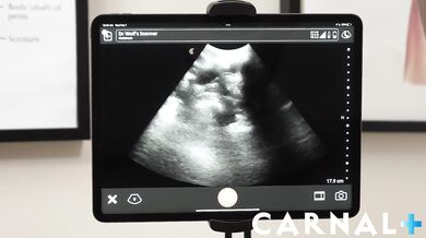 Anal Ultrasound NOAH Vol. 1