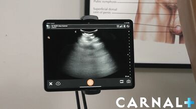 DAMIEN Chapter 9 - Anal Ultrasound